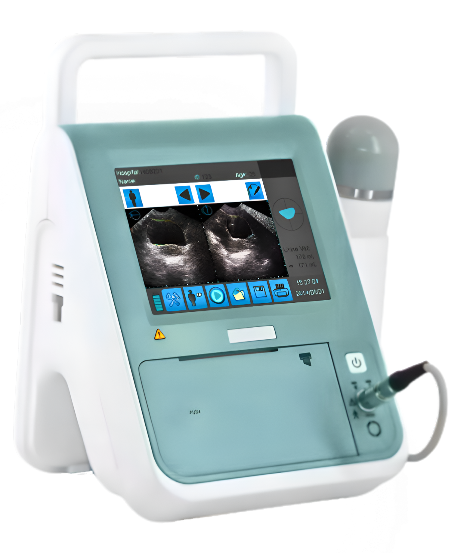 3D-Portable-Bladder-Scanner