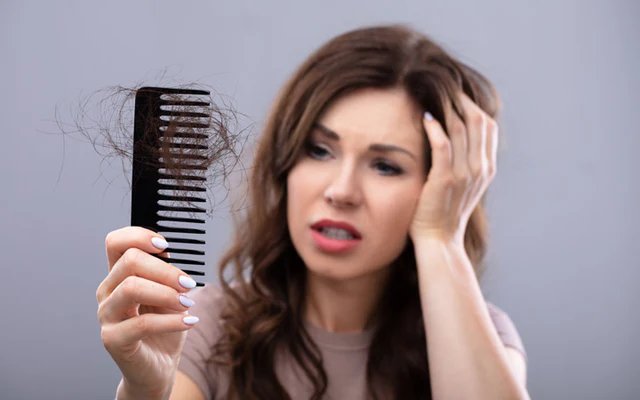 Hair-Loss