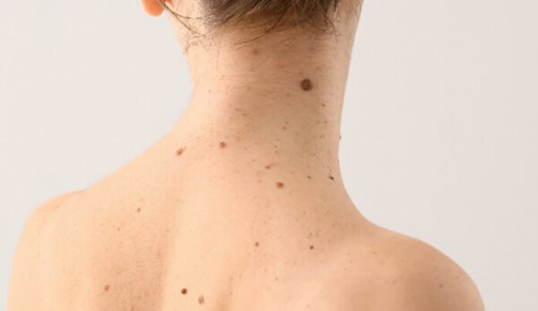Imagge of skin